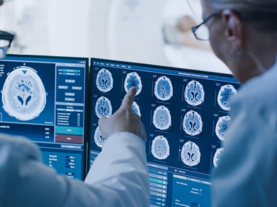 Understanding Serious TBIs: Traumatic Subarachnoid Hemorrhage and Brain Hemorrhage