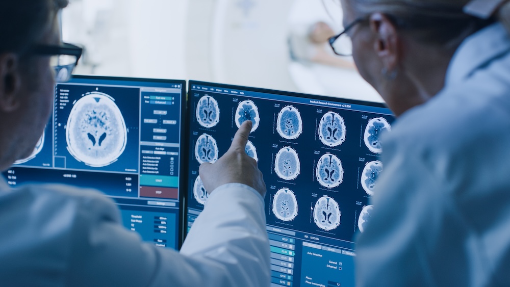 Understanding Serious TBIs Traumatic Subarachnoid Hemorrhage And Brain Hemorrhage